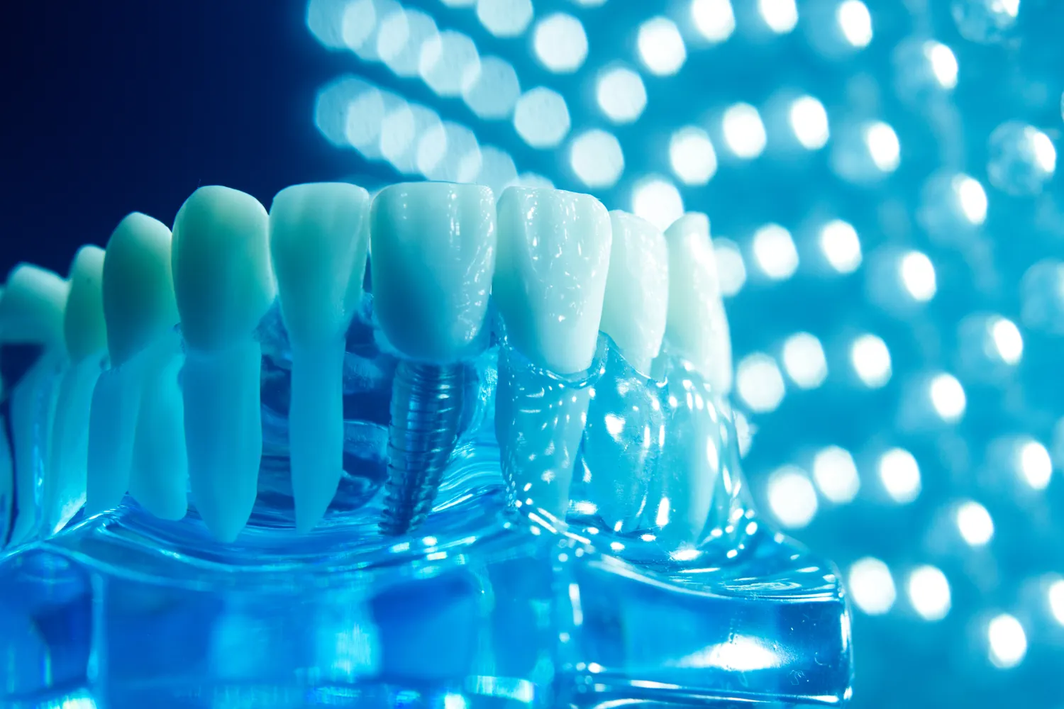 Protetyka zębów Lublin