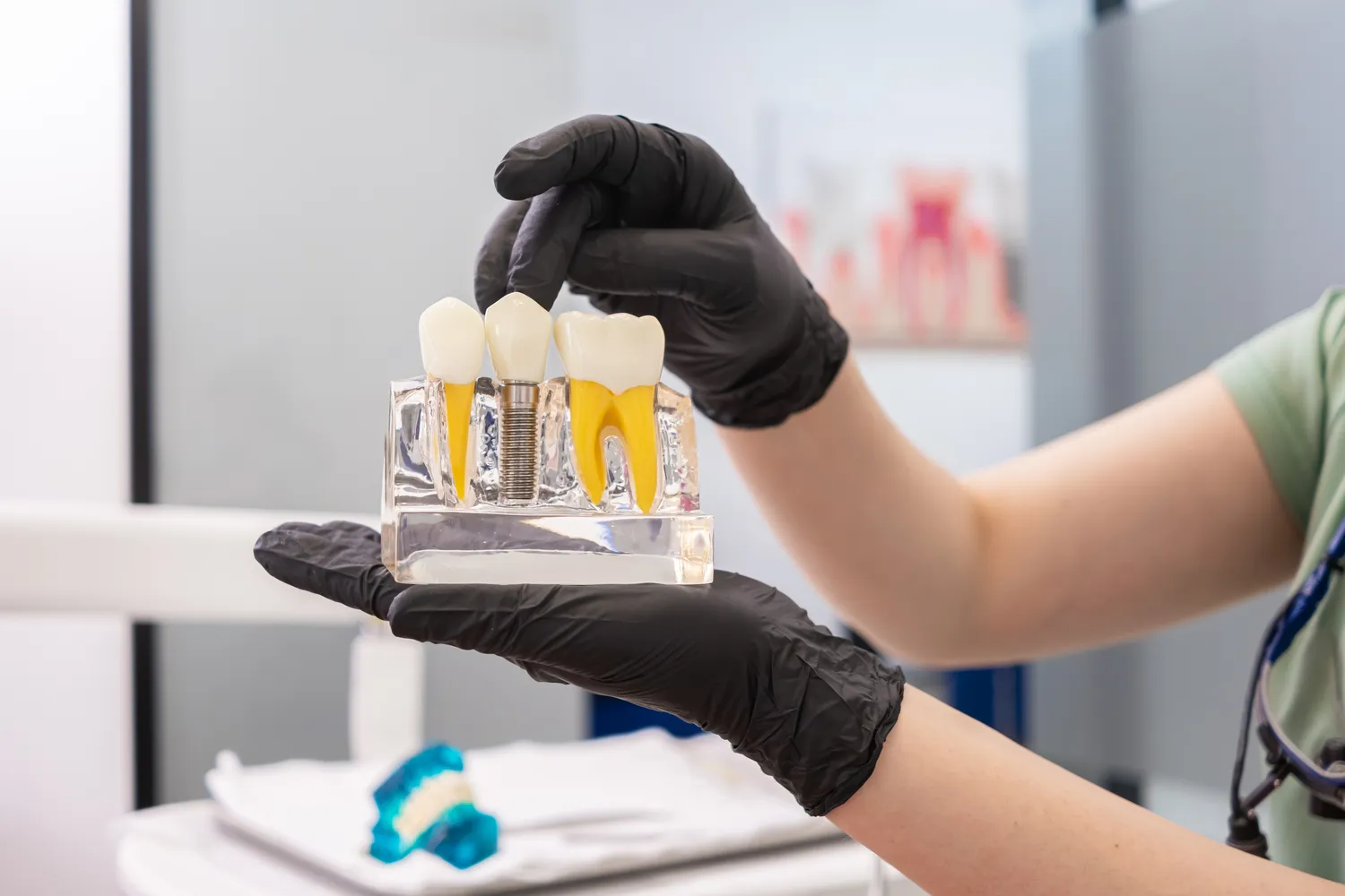 Implanty dentystyczne Szczecin