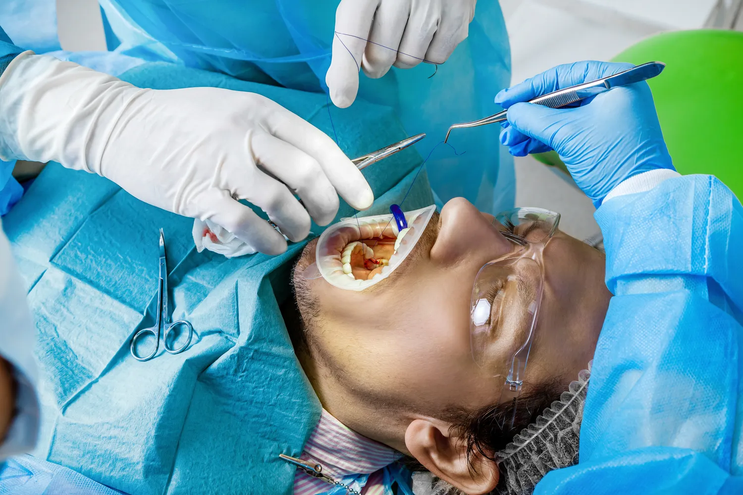 Ile trwa powiększanie ust?