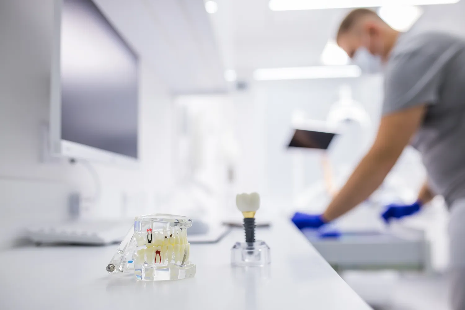 Jak sie zakłada implanty zębowe?