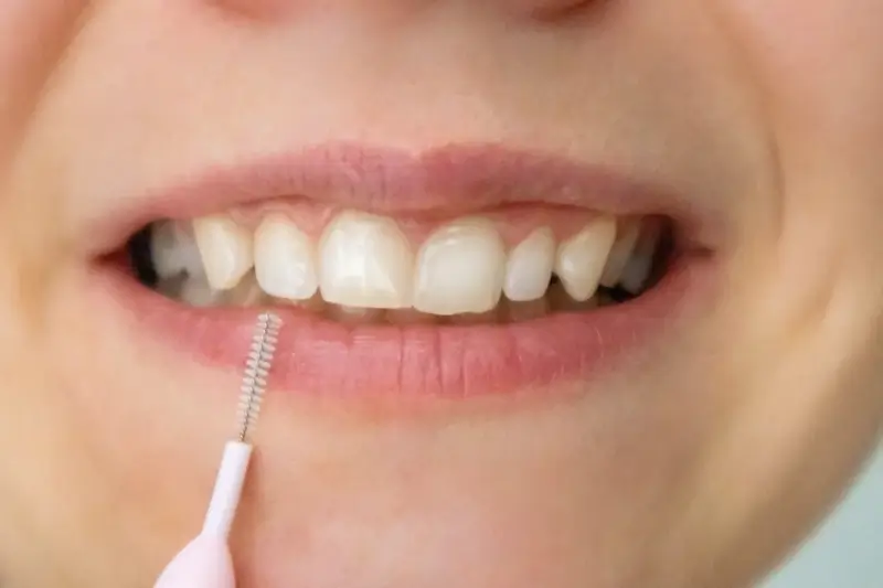 Leczenie stomatologiczne w czasie ciąży