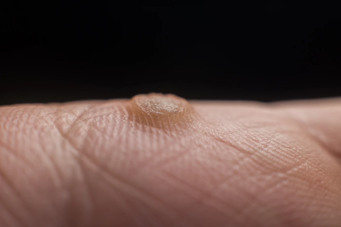 Do czego służy sonda do paznokci?