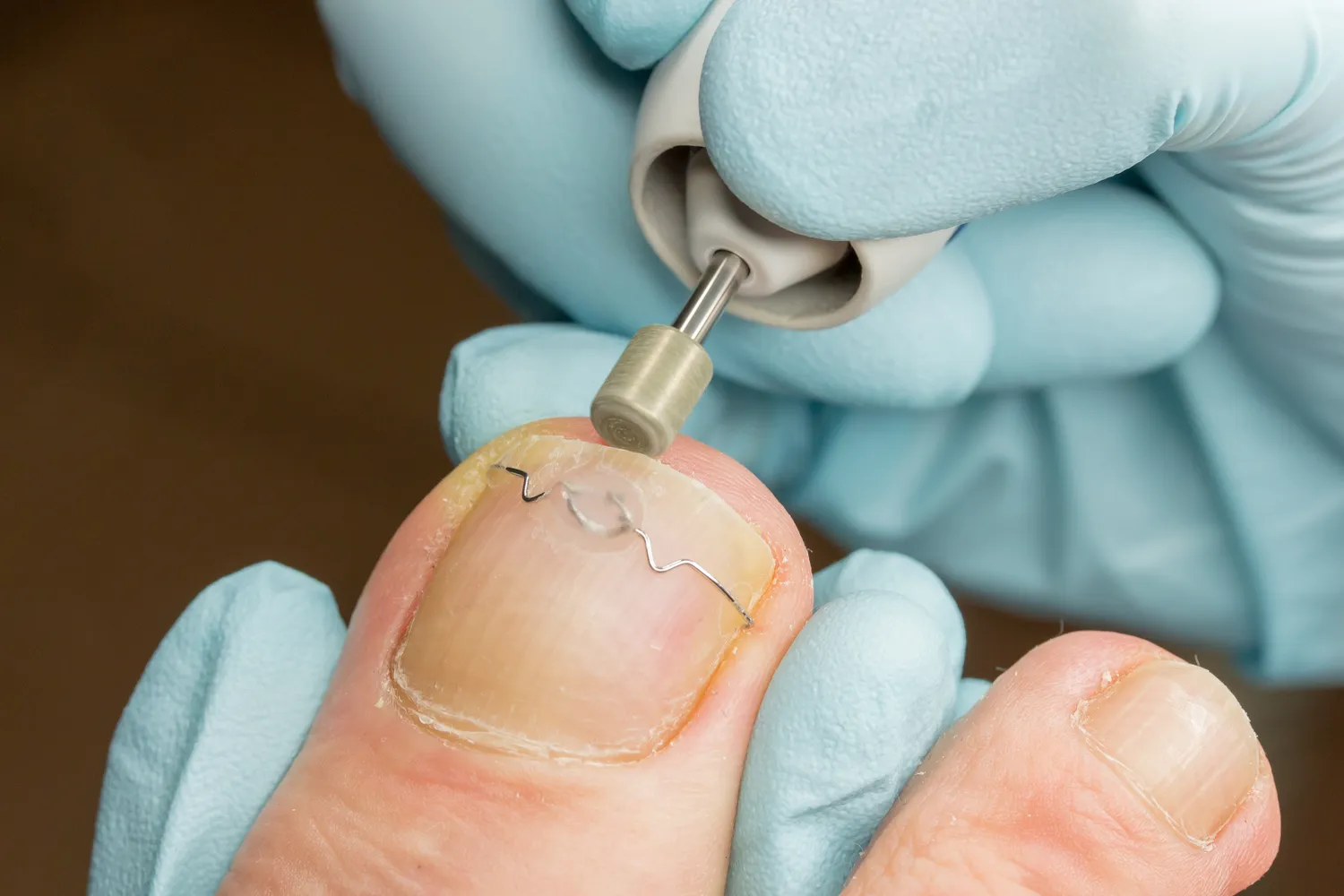 Podolog czym się zajmuje - co warto wiedzieć?